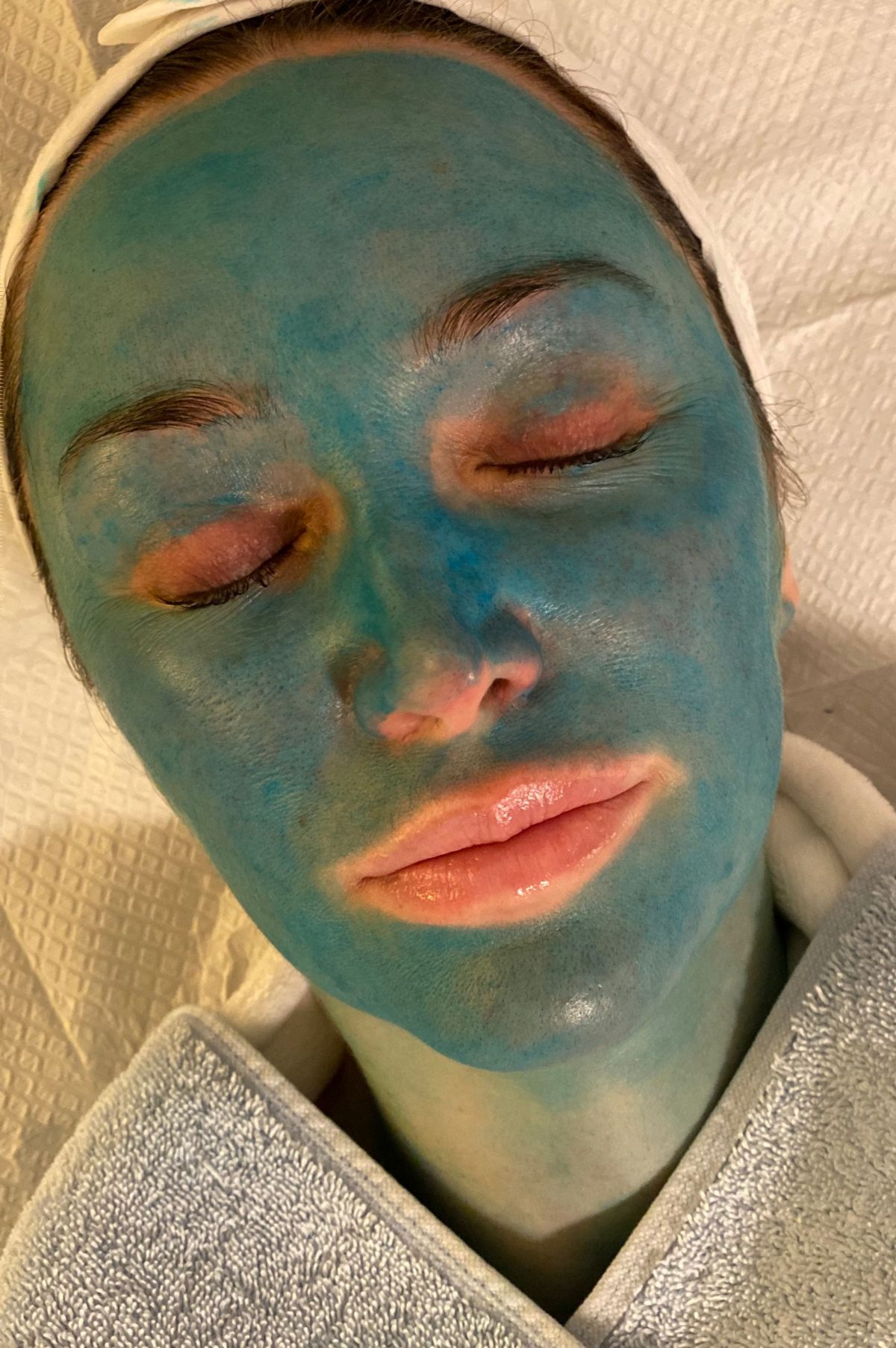 Trish undergoing an Obagi Blue Peel